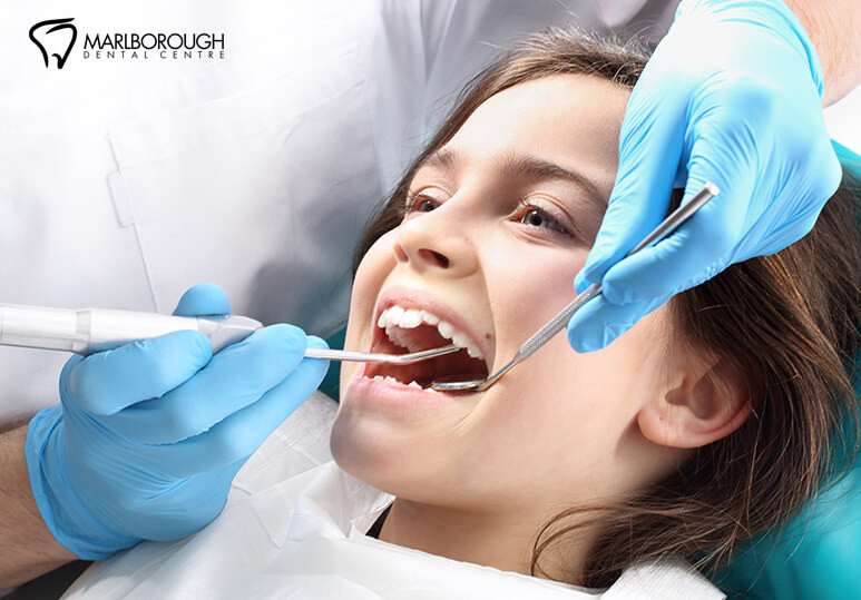 Marlborough Dental - Dental Scaling
